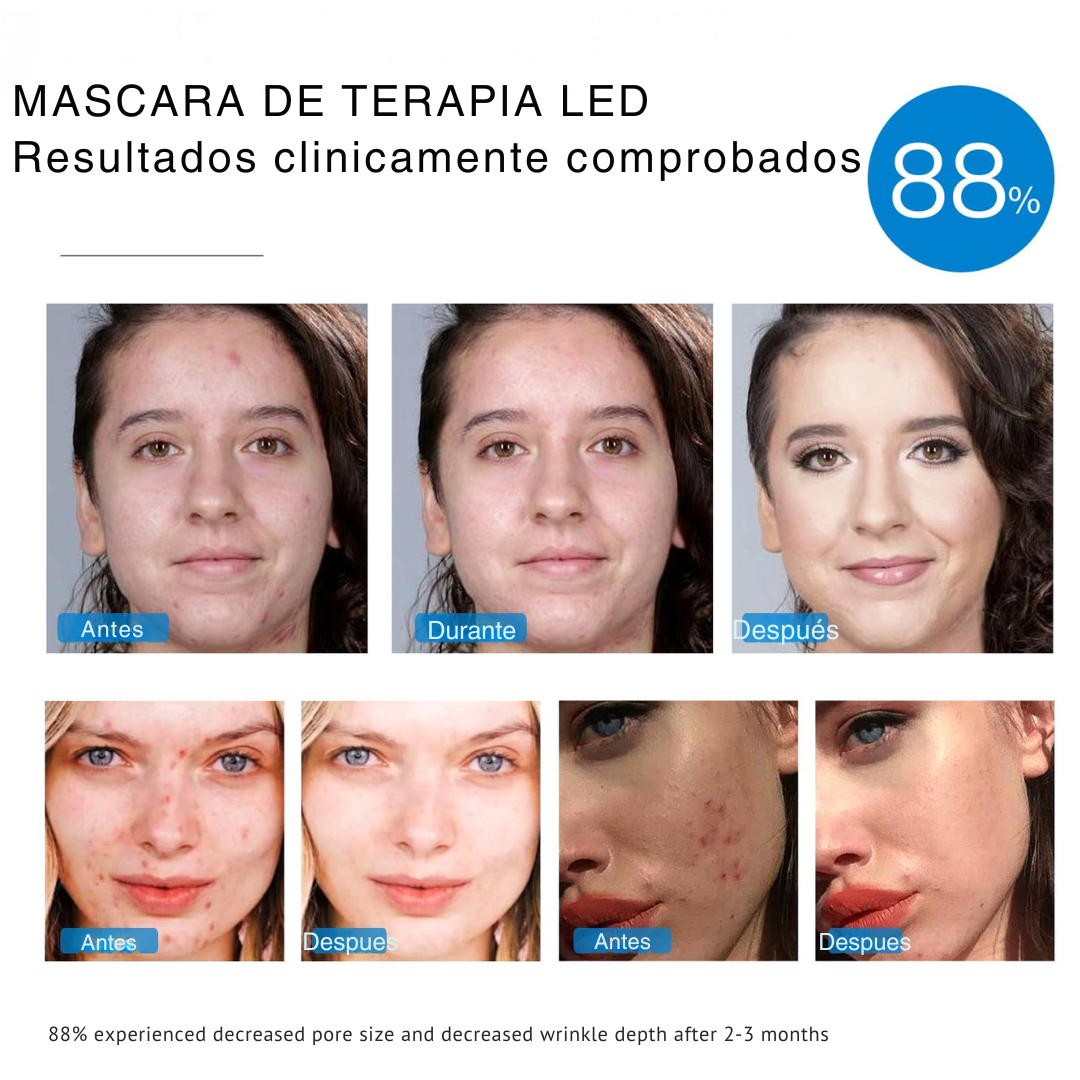 Zelnora GlowMask™ - Mascarilla LED